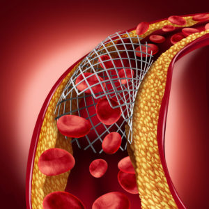 An illustration of vein conditions