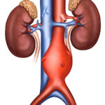 A drawing of the human body with two kidney sections.