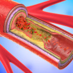 A blood vessel with red and green colored cells.